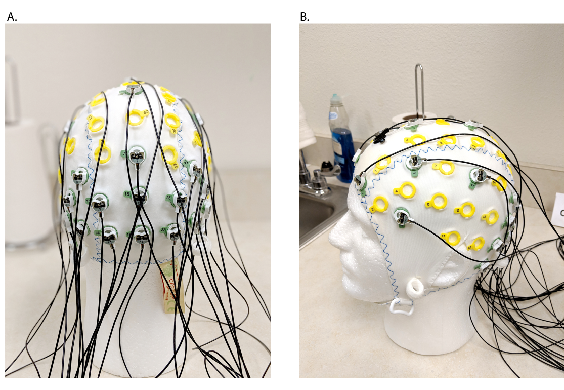 ../_images/EEG_proc_fig3.png