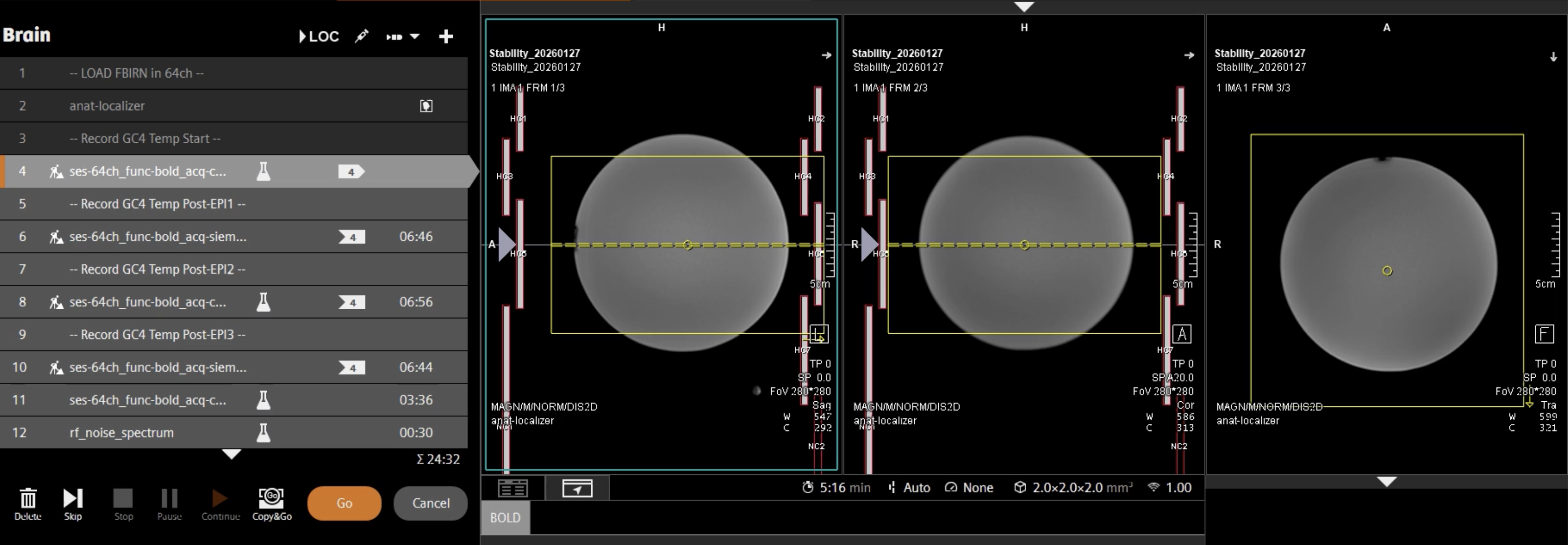 ../_images/stability_scan_setup.png